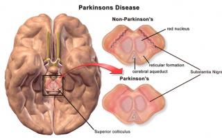 Vrijwilligers voor Parkinsonhuys gezocht